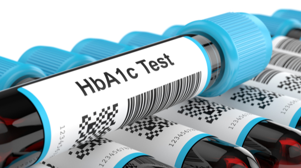 Diabetes tests- Hba1c