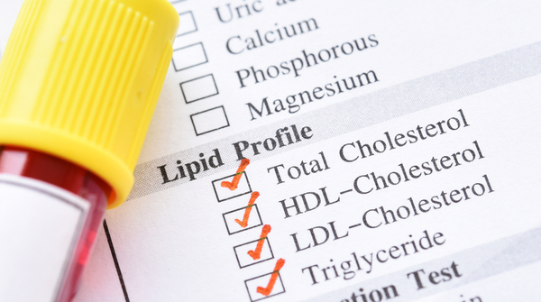 lipid test