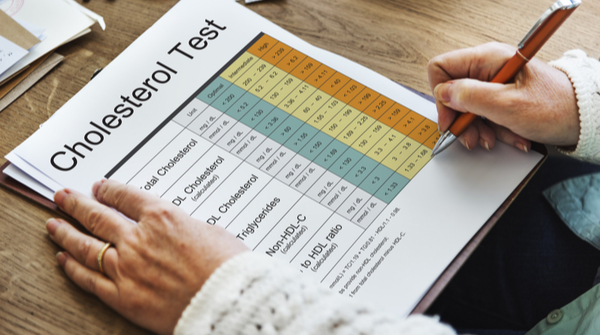 Cholesterol test