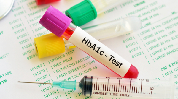 Diabetes test- Hba1c