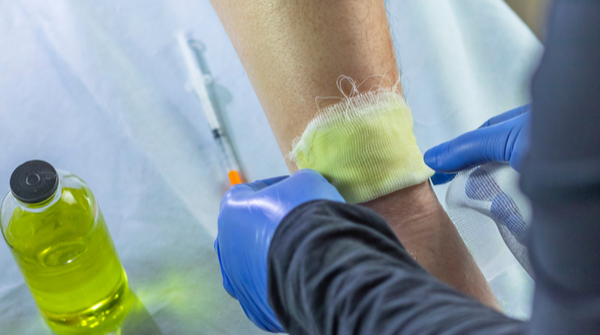 Slow healing of wounds