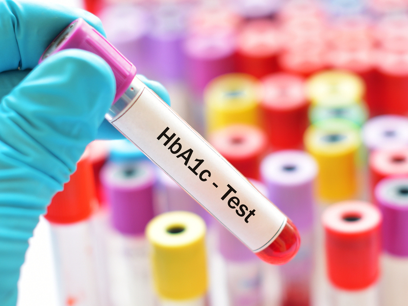 HbA1c test Effective Ways To Handle Your HbA1c Levels