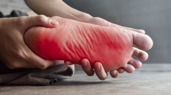 neuropathy