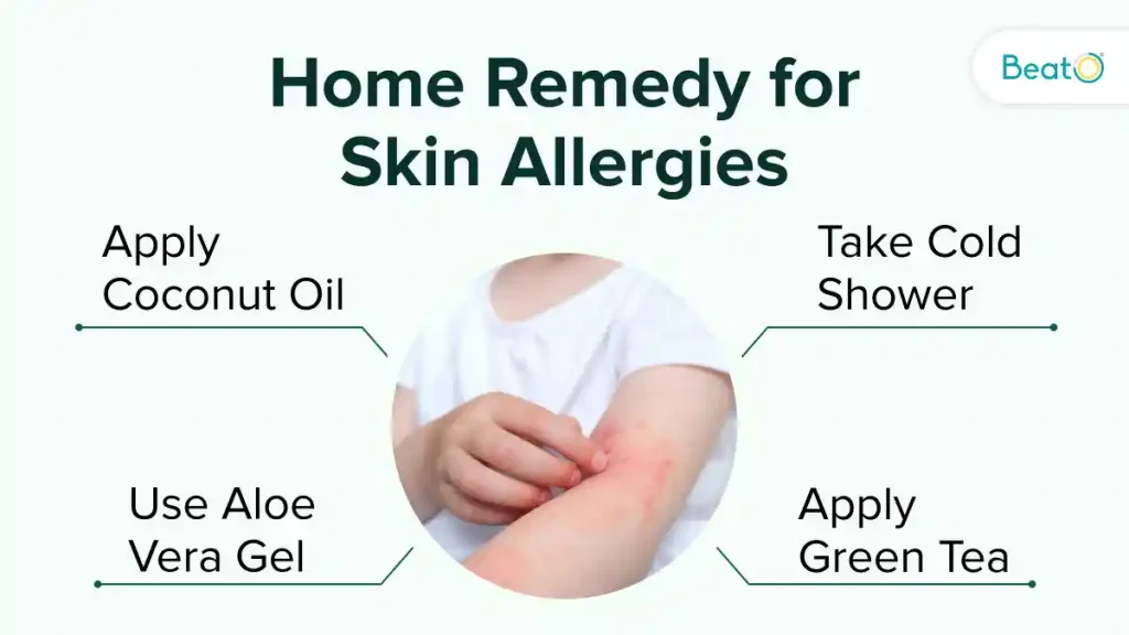 Home Made Skin Allergy Remedy