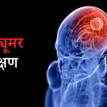 ब्रेन ट्यूमर के लक्षण