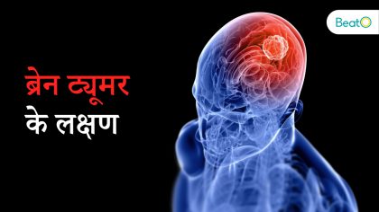 ब्रेन ट्यूमर के लक्षण