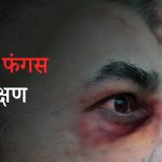 ब्लैक फंगस के लक्षण